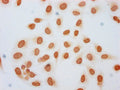 Immunocytochemistry analysis of CSB-PA010378OA45forHU diluted at 1:10 and staining in Hela cells (treated with 30mM sodium butyrate for 4h) performed on a Leica BondTM system. The cells were fixed in 4% formaldehyde, permeabilized using 0.2% Triton X-100 and blocked with 10% normal goat serum 30min at RT. Then primary antibody (1% BSA) was incubated at 4&deg;C overnight. The primary is detected by a biotinylated secondary antibody and visualized using an HRP conjugated SP system.