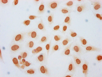 Immunocytochemistry analysis of CSB-PA010378OA45forHU diluted at 1:10 and staining in Hela cells (treated with 30mM sodium butyrate for 4h) performed on a Leica BondTM system. The cells were fixed in 4% formaldehyde, permeabilized using 0.2% Triton X-100 and blocked with 10% normal goat serum 30min at RT. Then primary antibody (1% BSA) was incubated at 4&deg;C overnight. The primary is detected by a biotinylated secondary antibody and visualized using an HRP conjugated SP system.