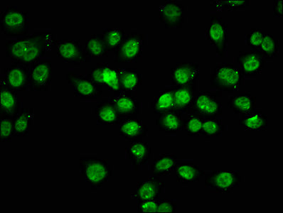 Immunofluorescence staining of Hela cells (treated with 30mM sodium butyrate for 4h) with CSB-PA010378OA74acHU at 1:7.5, counter-stained with DAPI. The cells were fixed in 4% formaldehyde, permeabilized using 0.2% Triton X-100 and blocked in 10% normal Goat Serum. The cells were then incubated with the antibody overnight at 4&deg;C. The secondary antibody was Alexa Fluor 488-congugated AffiniPure Goat Anti-Rabbit IgG(H+L).