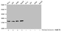 Western Blot
Detected samples: Hela whole cell lysate, 293 whole cell lysate, A549 whole cell lysate, HepG2 whole cell lysate; Untreated (-) or treated (+) with 30mM sodium butyrate for 4h
All lanes: HIST1H1C antibody at 2.6µg/ml
Secondary
Goat polyclonal to rabbit IgG at 1/50000 dilution
Predicted band size: 22 kDa
Observed band size: 22 kDa