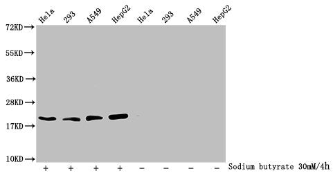 Western Blot
Detected samples: Hela whole cell lysate, 293 whole cell lysate, A549 whole cell lysate, HepG2 whole cell lysate; Untreated (-) or treated (+) with 30mM sodium butyrate for 4h
All lanes: HIST1H1C antibody at 2.6µg/ml
Secondary
Goat polyclonal to rabbit IgG at 1/50000 dilution
Predicted band size: 22 kDa
Observed band size: 22 kDa