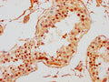 IHC image of CSB-PA010378PA167ncrHU diluted at 1:10 and staining in paraffin-embedded human testis tissue performed on a Leica BondTM system. After dewaxing and hydration, antigen retrieval was mediated by high pressure in a citrate buffer (pH 6.0). Section was blocked with 10% normal goat serum 30min at RT. Then primary antibody (1% BSA) was incubated at 4°C overnight. The primary is detected by a biotinylated secondary antibody and visualized using an HRP conjugated SP system.