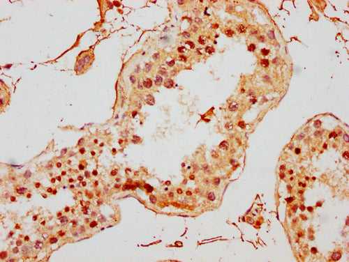 IHC image of CSB-PA010378PA167ncrHU diluted at 1:10 and staining in paraffin-embedded human testis tissue performed on a Leica BondTM system. After dewaxing and hydration, antigen retrieval was mediated by high pressure in a citrate buffer (pH 6.0). Section was blocked with 10% normal goat serum 30min at RT. Then primary antibody (1% BSA) was incubated at 4°C overnight. The primary is detected by a biotinylated secondary antibody and visualized using an HRP conjugated SP system.
