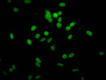 Immunofluorescent analysis of Hela cells (sodium butyrate, 30 mM, 4h) using CSB-PA010378PA51hibHU at dilution of 1:100 and Alexa Fluor 488-congugated AffiniPure Goat Anti-Rabbit IgG(H+L)