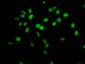 Immunofluorescent analysis of Hela cells (sodium butyrate, 30 mM, 4h) using CSB-PA010378PA63hibHU at dilution of 1:100 and Alexa Fluor 488-congugated AffiniPure Goat Anti-Rabbit IgG(H+L)
