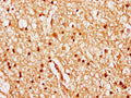 IHC image of CSB-PA010378PA84nhibHU diluted at 1:20 and staining in paraffin-embedded human brain tissue performed on a Leica BondTM system. After dewaxing and hydration, antigen retrieval was mediated by high pressure in a citrate buffer (pH 6.0). Section was blocked with 10% normal goat serum 30min at RT. Then primary antibody (1% BSA) was incubated at 4°C overnight. The primary is detected by a biotinylated secondary antibody and visualized using an HRP conjugated SP system.