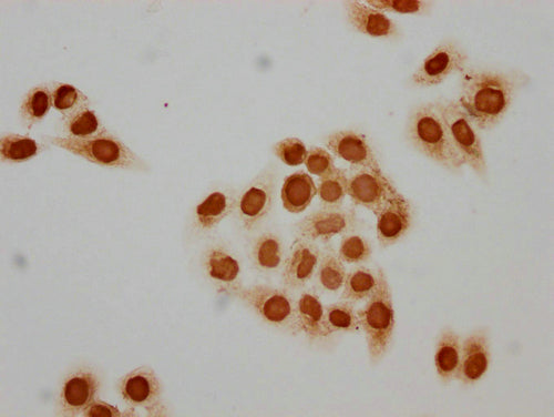 Immunocytochemistry analysis of CSB-PA010378PA89acHU diluted at 1:15 and staining in Hela cells(treated with 30mM sodium butyrate for 4h) performed on a Leica BondTM system. The cells were fixed in 4% formaldehyde, permeabilized using 0.2% Triton X-100 and blocked with 10% normal goat serum 30min at RT. Then primary antibody (1% BSA) was incubated at 4°C overnight. The primary is detected by a biotinylated secondary antibody and visualized using an HRP conjugated SP system.