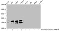 Western Blot
Detected samples: Hela whole cell lysate, 293 whole cell lysate, K562 whole cell lysate, Jurkat whole cell lysate; Untreated (-) or treated (+) with 30mM sodium butyrate for 4h
All lanes: HIST1H1C antibody at 1:2000
Secondary
Goat polyclonal to rabbit IgG at 1/40000 dilution
Predicted band size: 22 kDa
Observed band size: 22 kDa