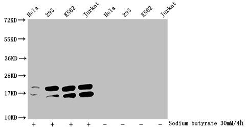 Western Blot
Detected samples: Hela whole cell lysate, 293 whole cell lysate, K562 whole cell lysate, Jurkat whole cell lysate; Untreated (-) or treated (+) with 30mM sodium butyrate for 4h
All lanes: HIST1H1C antibody at 1:2000
Secondary
Goat polyclonal to rabbit IgG at 1/40000 dilution
Predicted band size: 22 kDa
Observed band size: 22 kDa