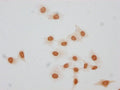 Immunocytochemistry analysis of CSB-PA010379OA140forHU diluted at 1:20 and staining in Hela cells(treated with 30mM sodium butyrate for 4h) performed on a Leica BondTM system. The cells were fixed in 4% formaldehyde, permeabilized using 0.2% Triton X-100 and blocked with 10% normal goat serum 30min at RT. Then primary antibody (1% BSA) was incubated at 4°C overnight. The primary is detected by a biotinylated secondary antibody and visualized using an HRP conjugated SP system.