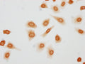 Immunocytochemistry analysis of CSB-PA010379OA146phHU diluted at 1:10 and staining in Hela cells(treated with 50nM Calyculin A for 30min) performed on a Leica BondTM system. The cells were fixed in 4% formaldehyde, permeabilized using 0.2% Triton X-100 and blocked with 10% normal goat serum 30min at RT. Then primary antibody (1% BSA) was incubated at 4°C overnight. The primary is detected by a biotinylated secondary antibody and visualized using an HRP conjugated SP system.