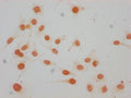 Immunocytochemistry analysis of CSB-PA010380OA147me1HU diluted at 1:15 and staining in Hela cells performed on a Leica BondTM system. The cells were fixed in 4% formaldehyde, permeabilized using 0.2% Triton X-100 and blocked with 10% normal goat serum 30min at RT. Then primary antibody (1% BSA) was incubated at 4°C overnight. The primary is detected by a biotinylated secondary antibody and visualized using an HRP conjugated SP system.