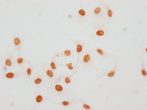 Immunocytochemistry analysis of CSB-PA010380OA45acHU diluted at 1:15 and staining in Hela cells(treated with 30mM sodium butyrate for 4h) performed on a Leica BondTM system. The cells were fixed in 4% formaldehyde, permeabilized using 0.2% Triton X-100 and blocked with 10% normal goat serum 30min at RT. Then primary antibody (1% BSA) was incubated at 4°C overnight. The primary is detected by a biotinylated secondary antibody and visualized using an HRP conjugated SP system.