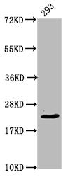 Western Blot
Positive WB detected in: 293 whole cell lysate
All lanes: HIST1H1E antibody at 0.94µg/ml
Secondary
Goat polyclonal to rabbit IgG at 1/50000 dilution
Predicted band size: 22 kDa
Observed band size: 22 kDa