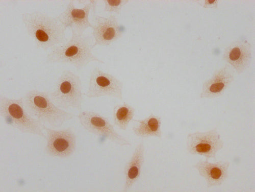 Immunocytochemistry analysis of CSB-PA010380OA63forHU diluted at 1:10 and staining in Hela cells(treated with 30mM sodium butyrate for 4h) performed on a Leica BondTM system. The cells were fixed in 4% formaldehyde, permeabilized using 0.2% Triton X-100 and blocked with 10% normal goat serum 30min at RT. Then primary antibody (1% BSA) was incubated at 4°C overnight. The primary is detected by a biotinylated secondary antibody and visualized using an HRP conjugated SP system.