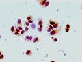 Immunocytochemistry analysis of MCF-7 cells using CSB-PA010380PA16acHU at dilution of 1:100