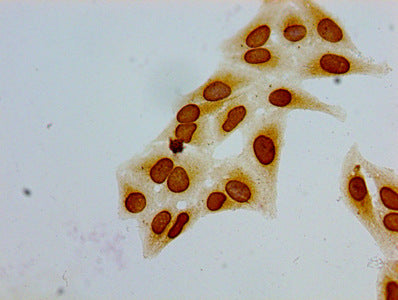 Immunocytochemistry analysis of Hela cells using CSB-PA010380PA51acHU at dilution of 1:100