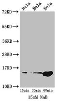 Western Blot
Positive WB detected in: Hela cell acid extracts treated by NaB
All lanes: HIST1H2AG antibody at 1.5µg/ml
Secondary
Goat polyclonal to rabbit IgG at 1/50000 dilution
Predicted band size: 15 kDa
Observed band size: 15 kDa