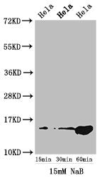 Western Blot
Positive WB detected in: Hela cell acid extracts treated by NaB
All lanes: HIST1H2AG antibody at 1.5µg/ml
Secondary
Goat polyclonal to rabbit IgG at 1/50000 dilution
Predicted band size: 15 kDa
Observed band size: 15 kDa