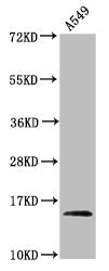 Western Blot
Positive WB detected in: A549 whole cell lysate (treated by 30mM sodium butyrate for 4h)
All lanes: HIST1H2AG antibody at 0.44µg/ml
Secondary
Goat polyclonal to rabbit IgG at 1/50000 dilution
Predicted band size: 15 kDa
Observed band size: 15 kDa
