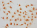 Immunocytochemistry analysis of CSB-PA010389OA119crHU diluted at 1:100 and staining in Hela cells(treated with 30mM sodium crotonylate for 4h) performed on a Leica BondTM system. The cells were fixed in 4% formaldehyde, permeabilized using 0.2% Triton X-100 and blocked with 10% normal goat serum 30min at RT. Then primary antibody (1% BSA) was incubated at 4°C overnight. The primary is detected by a biotinylated secondary antibody and visualized using an HRP conjugated SP system.