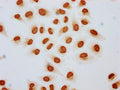 Immunocytochemistry analysis of CSB-PA010389OA15acHU diluted at 1:3 and staining in Hela cells (treated with 30mM sodium butyrate for 4h) performed on a Leica BondTM system. The cells were fixed in 4% formaldehyde, permeabilized using 0.2% Triton X-100 and blocked with 10% normal goat serum 30min at RT. Then primary antibody (1% BSA) was incubated at 4&deg;C overnight. The primary is detected by a biotinylated secondary antibody and visualized using an HRP conjugated SP system.