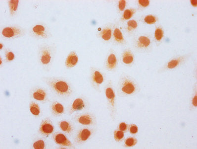 Immunocytochemistry analysis of CSB-PA010389OA36hibHU diluted at 1:20 and staining in Hela cells (treated with 30mM sodium butyrate for 4h) performed on a Leica BondTM system. The cells were fixed in 4% formaldehyde, permeabilized using 0.2% Triton X-100 and blocked with 10% normal goat serum 30min at RT. Then primary antibody (1% BSA) was incubated at 4&deg;C overnight. The primary is detected by a biotinylated secondary antibody and visualized using an HRP conjugated SP system.