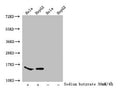 Western Blot
Detected samples: Hela whole cell lysate, HepG2 whole cell lysate; Untreated (-) or treated (+) with 30mM sodium butyrate for 4h
All lanes: HIST1H2AG antibody at 1:100
Secondary
Goat polyclonal to rabbit IgG at 1/50000 dilution
Predicted band size: 15 kDa
Observed band size: 15 kDa