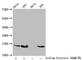 Western Blot
Detected samples: Hela whole cell lysate, 293 whole cell lysate; Untreated (-) or treated (+) with 30mM sodium butyrate for 4h
All lanes: HIST1H2AG antibody at 1:100
Secondary
Goat polyclonal to rabbit IgG at 1/50000 dilution
Predicted band size: 15 kDa
Observed band size: 15 kDa