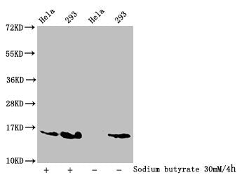 Western Blot
Detected samples: Hela whole cell lysate, 293 whole cell lysate; Untreated (-) or treated (+) with 30mM sodium butyrate for 4h
All lanes: HIST1H2AG antibody at 1:100
Secondary
Goat polyclonal to rabbit IgG at 1/50000 dilution
Predicted band size: 15 kDa
Observed band size: 15 kDa