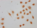 Immunocytochemistry analysis of CSB-PA010389PA09acHU diluted at 1:10 and staining in Hela cells(treated with 30mM sodium butyrate for 4h) performed on a Leica BondTM system. The cells were fixed in 4% formaldehyde, permeabilized using 0.2% Triton X-100 and blocked with 10% normal goat serum 30min at RT. Then primary antibody (1% BSA) was incubated at 4°C overnight. The primary is detected by a biotinylated secondary antibody and visualized using an HRP conjugated SP system.