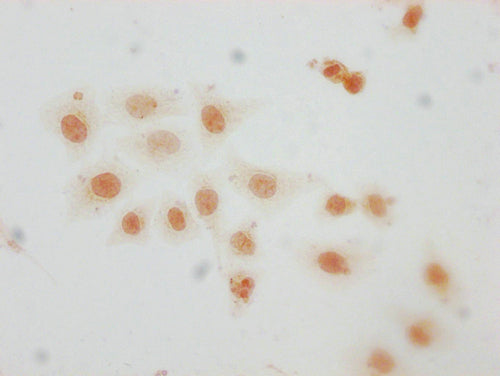 Immunocytochemistry analysis of CSB-PA010389PA29me1HU diluted at 1:10 and staining in Hela cells performed on a Leica BondTM system. The cells were fixed in 4% formaldehyde, permeabilized using 0.2% Triton X-100 and blocked with 10% normal goat serum 30min at RT. Then primary antibody (1% BSA) was incubated at 4°C overnight. The primary is detected by a biotinylated secondary antibody and visualized using an HRP conjugated SP system.