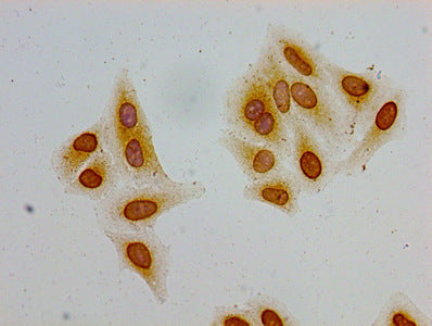 Immunocytochemistry analysis of Hela cells using CSB-PA010389PA36acHU at dilution of 1:100