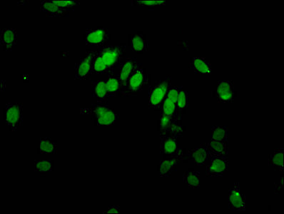 Immunofluorescent analysis of Hela cells (sodium butyrate, 30 mM, 4h) using CSB-PA010389PA95hibHU at dilution of 1:100 and Alexa Fluor 488-congugated AffiniPure Goat Anti-Rabbit IgG(H+L)