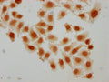 Immunocytochemistry analysis of CSB-PA010389PA95sucHU diluted at 1:10 and staining in Hela cells(treated with 10mM disodium succinylate for 4h) performed on a Leica BondTM system. The cells were fixed in 4% formaldehyde, permeabilized using 0.2% Triton X-100 and blocked with 10% normal goat serum 30min at RT. Then primary antibody (1% BSA) was incubated at 4°C overnight. The primary is detected by a biotinylated secondary antibody and visualized using an HRP conjugated SP system.