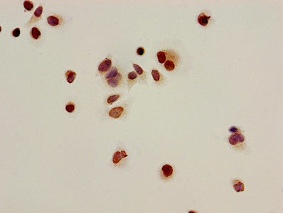 Immunocytochemistry analysis of Hela cells using CSB-PA010402OA16acHU at dilution of 1:100