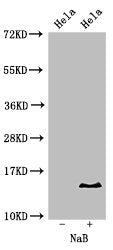 Western Blot
Positive WB detected in: Hela cell acid extracts treated by NaB
All lanes: HIST1H2BB antibody at 2µg/ml
Secondary
Goat polyclonal to rabbit IgG at 1/50000 dilution
Predicted band size: 14 kDa
Observed band size: 14 kDa