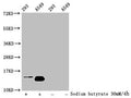 Western Blot
Detected samples: 293 whole cell lysate, A549 whole cell lysate; Untreated (-) or treated (+) with 30mM sodium butyrate for 4h
All lanes: HIST1H2BC antibody at 1:100
Secondary
Goat polyclonal to rabbit IgG at 1/50000 dilution
Predicted band size: 14 kDa
Observed band size: 14 kDa