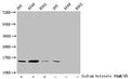 Western Blot
Detected samples: 293 whole cell lysate, A549 whole cell lysate, K562 whole cell lysate; Untreated (-) or treated (+) with 30mM sodium butyrate for 4h
All lanes: HIST1H2BC antibody at 1:100
Secondary
Goat polyclonal to rabbit IgG at 1/50000 dilution
Predicted band size: 14 kDa
Observed band size: 14 kDa