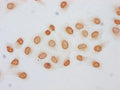 Immunocytochemistry analysis of CSB-PA010403OA120acHU diluted at 1:5 and staining in Hela cells (treated with 30mM sodium butyrate for 4h) performed on a Leica BondTM system. The cells were fixed in 4% formaldehyde, permeabilized using 0.2% Triton X-100 and blocked with 10% normal goat serum 30min at RT. Then primary antibody (1% BSA) was incubated at 4&deg;C overnight. The primary is detected by a biotinylated secondary antibody and visualized using an HRP conjugated SP system.