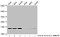 Western Blot
Detected samples: A549 whole cell lysate, K562 whole cell lysate, HepG2 whole cell lysate; Untreated (-) or treated (+) with 30mM sodium butyrate for 4h
All lanes: HIST1H2BC antibody at 1:100
Secondary
Goat polyclonal to rabbit IgG at 1/50000 dilution
Predicted band size: 14 kDa
Observed band size: 14 kDa