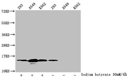 Western Blot
Detected samples: 293 whole cell lysate, A549 whole cell lysate, K562 whole cell lysate; Untreated (-) or treated (+) with 30mM sodium butyrate for 4h
All lanes: HIST1H2BC antibody at 1:100
Secondary
Goat polyclonal to rabbit IgG at 1/50000 dilution
Predicted band size: 14 kDa
Observed band size: 14 kDa