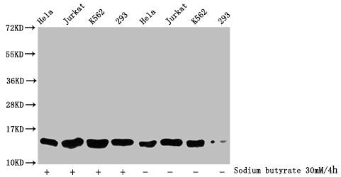 Western Blot
Detected samples: Hela whole cell lysate, Jurkat whole cell lysate, K562 whole cell lysate, 293 whole cell lysate; Untreated (-) or treated (+) with 30mM sodium butyrate for 4h
All lanes: HIST1H2BC antibody at 1:500
Secondary
Goat polyclonal to rabbit IgG at 1/40000 dilution
Predicted band size: 14 kDa
Observed band size: 14 kDa