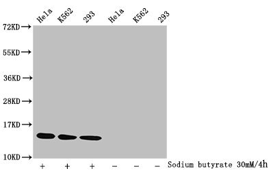 Western Blot
Detected samples: Hela whole cell lysate, K562 whole cell lysate, 293 whole cell lysate; Untreated (-) or treated (+) with 30mM sodium butyrate for 4h
All lanes: HIST1H2BC antibody at 1:1000
Secondary
Goat polyclonal to rabbit IgG at 1/40000 dilution
Predicted band size: 14 kDa
Observed band size: 14 kDa