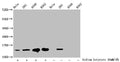 Western Blot
Detected samples: Hela whole cell lysate, 293 whole cell lysate, A549 whole cell lysate, K562 whole cell lysate; Untreated (-) or treated (+) with 30mM sodium butyrate for 4h
All lanes: HIST1H2BC antibody at 1:100
Secondary
Goat polyclonal to rabbit IgG at 1/50000 dilution
Predicted band size: 14 kDa
Observed band size: 14 kDa