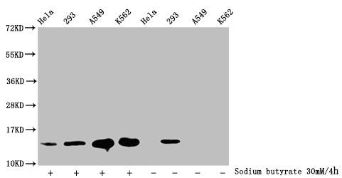 Western Blot
Detected samples: Hela whole cell lysate, 293 whole cell lysate, A549 whole cell lysate, K562 whole cell lysate; Untreated (-) or treated (+) with 30mM sodium butyrate for 4h
All lanes: HIST1H2BC antibody at 1:100
Secondary
Goat polyclonal to rabbit IgG at 1/50000 dilution
Predicted band size: 14 kDa
Observed band size: 14 kDa