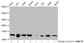 Western Blot
Detected samples: Hela whole cell lysate, 293 whole cell lysate, A549 whole cell lysate, HepG2 whole cell lysate; Untreated (-) or treated (+) with 30mM sodium butyrate for 4h
All lanes: HIST1H2BC antibody at 1:100
Secondary
Goat polyclonal to rabbit IgG at 1/50000 dilution
Predicted band size: 14 kDa
Observed band size: 14 kDa