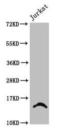 Western Blot
Positive WB detected in: Jurkat whole cell lysate (treated with 30mM sodium butyrate for 4h)
All lanes: HIST1H2BC antibody at 2.4µg/ml
Secondary
Goat polyclonal to rabbit IgG at 1/50000 dilution
Predicted band size: 14 kDa
Observed band size: 14 kDa