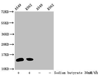 Western Blot
Detected samples: A549 whole cell lysate, K562 whole cell lysate; Untreated (-) or treated (+) with 30mM sodium butyrate for 4h
All lanes: HIST1H2BC antibody at 1:100
Secondary
Goat polyclonal to rabbit IgG at 1/50000 dilution
Predicted band size: 14 kDa
Observed band size: 14 kDa
