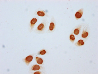 Immunocytochemistry analysis of CSB-PA010403OA85acHU diluted at 1:5 and staining in Hela cells (treated with 30mM sodium butyrate for 4h) performed on a Leica BondTM system. The cells were fixed in 4% formaldehyde, permeabilized using 0.2% Triton X-100 and blocked with 10% normal goat serum 30min at RT. Then primary antibody (1% BSA) was incubated at 4&deg;C overnight. The primary is detected by a biotinylated secondary antibody and visualized using an HRP conjugated SP system.